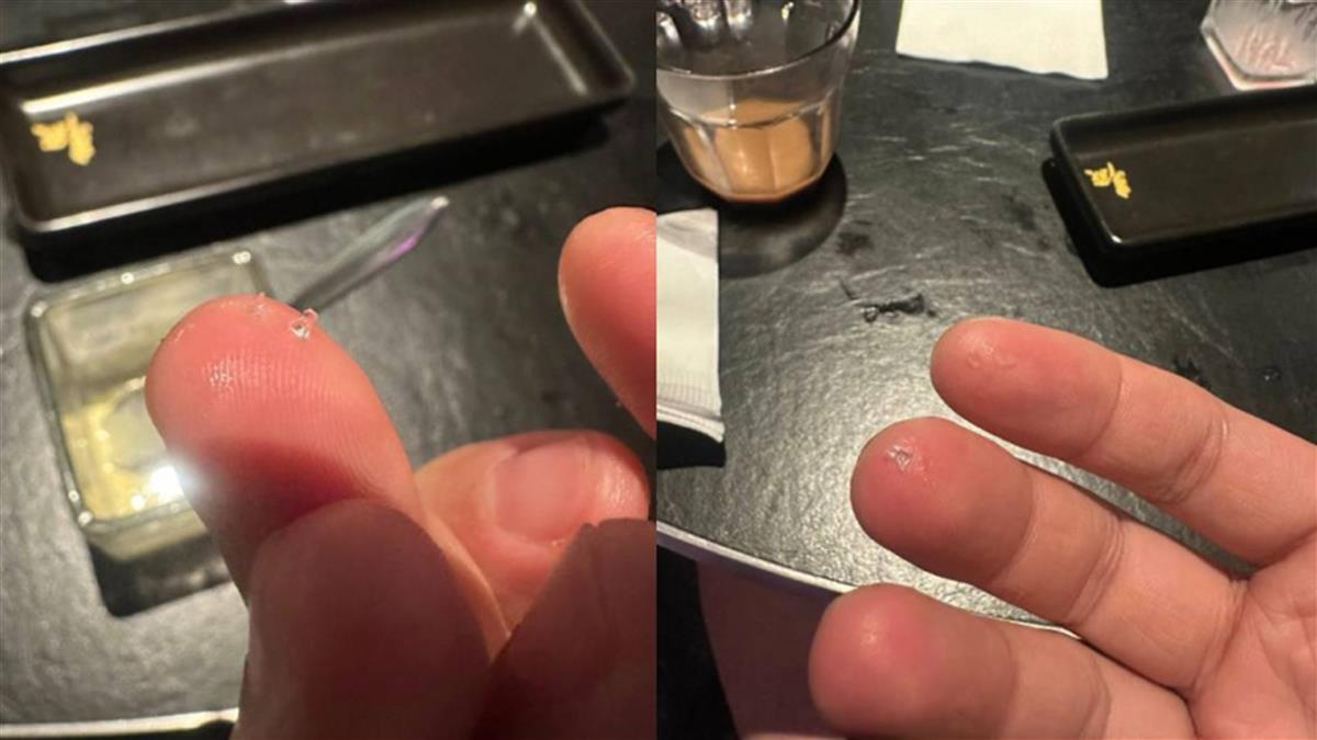 嗑鍋吃到玻璃片！他喉嚨出血趕送醫 店家竟要他「先做這事」