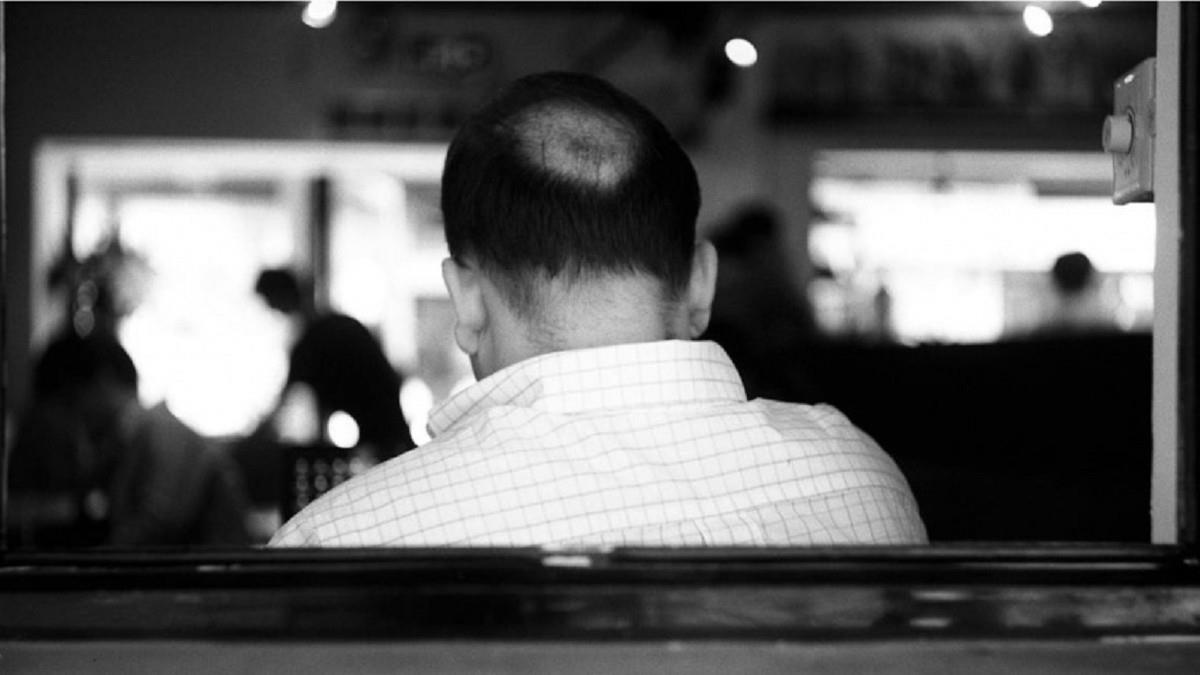 「含糖飲料」喝太多小心禿頭！ 超過這數字 風險增3.36倍