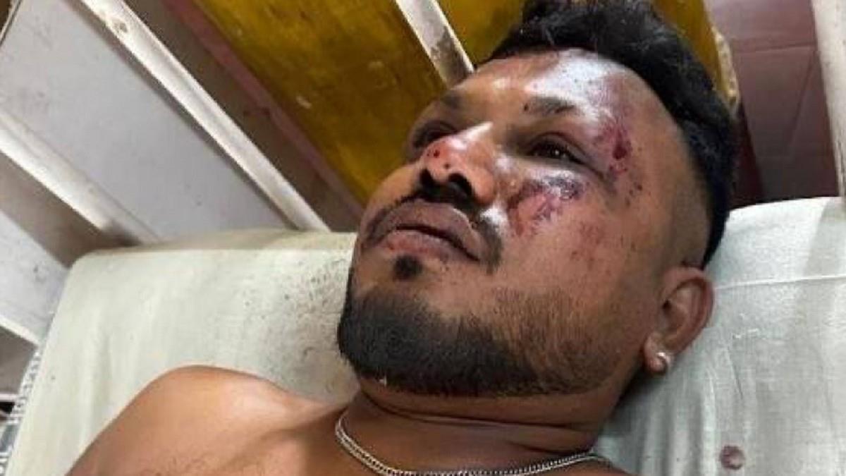 印度空難1人倖存！ 他染血走出飛機殘骸：周圍都是屍體