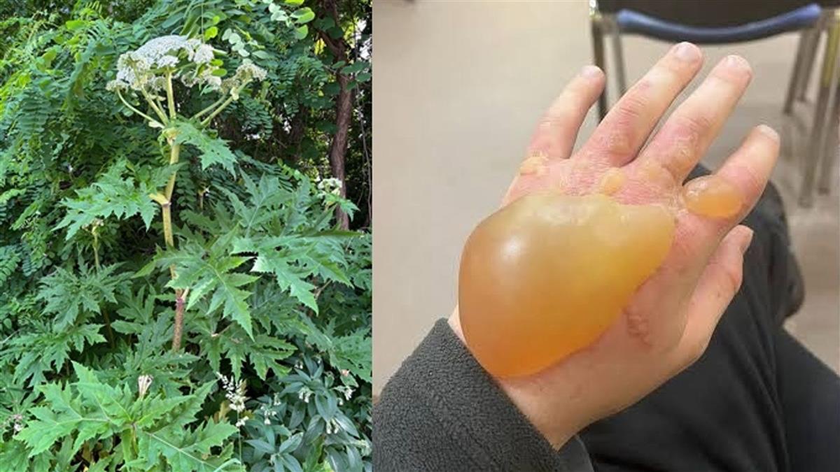 赴日旅遊注意！北海道又見「最危險植物」 碰到恐毀容、失明