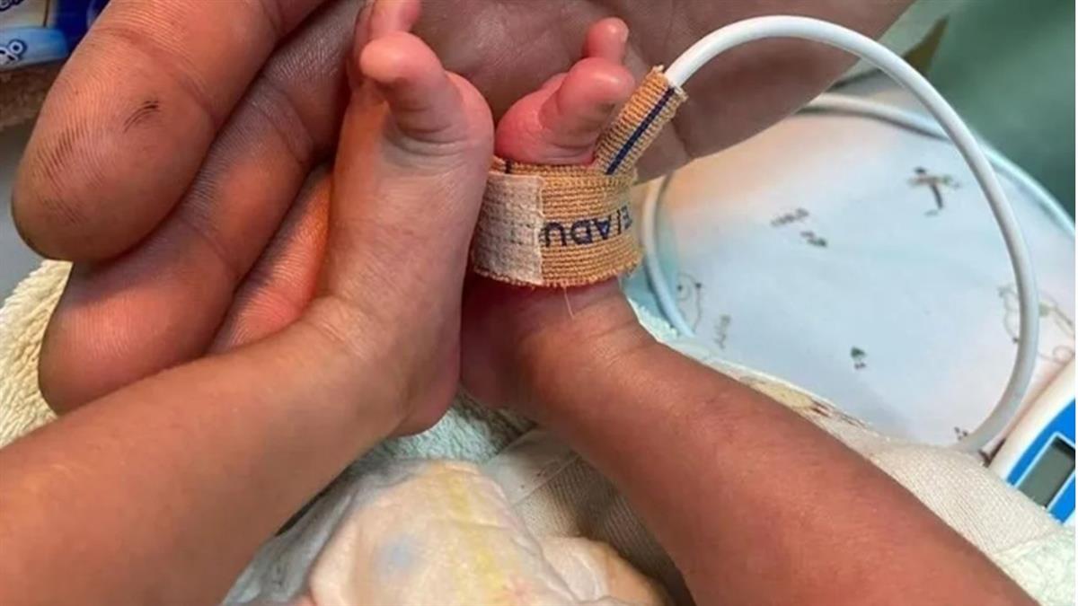 台南早產兒今轉院「全程需插管」 她求駕駛禮讓開路 萬人點讚聲援